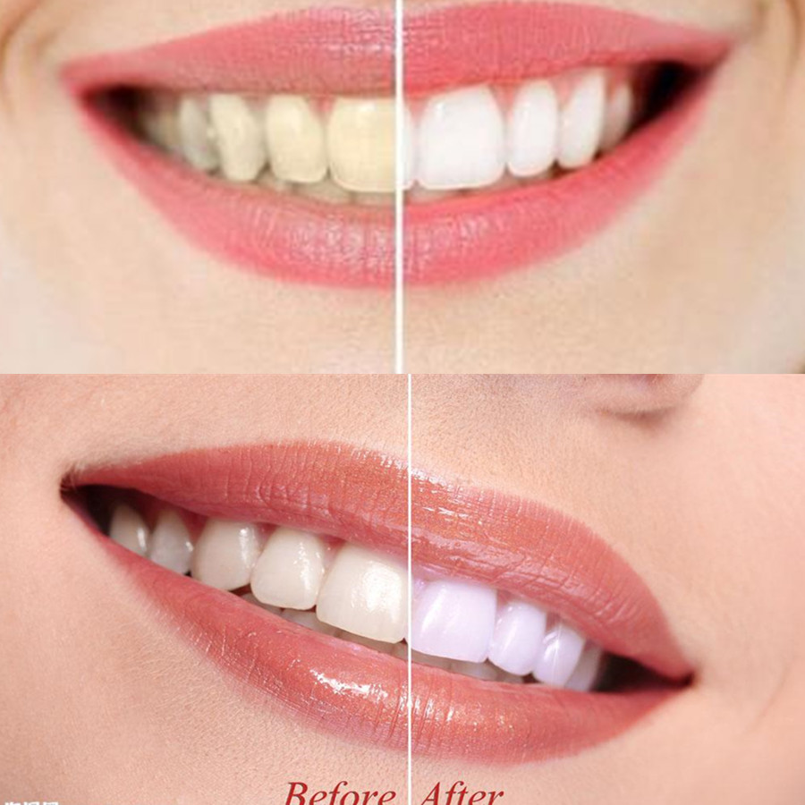 Бамбуковый уголь для зубов, ст – обзор и цена Teeth Whitening Charcoal Powder