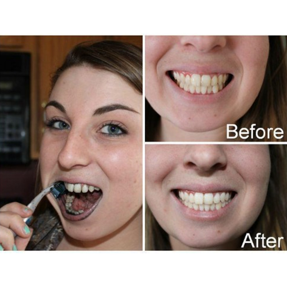 Бамбуковый уголь для зубов, ст – обзор и цена Teeth Whitening Charcoal Powder