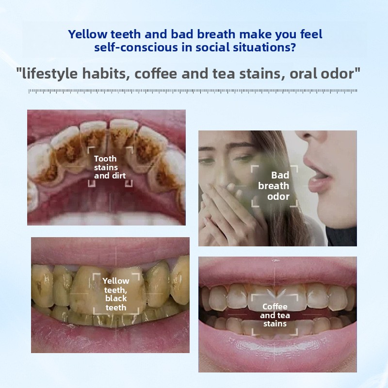 Ферментный отбеливающий и осве – обзор и цена Teeth Whitening Enzymes