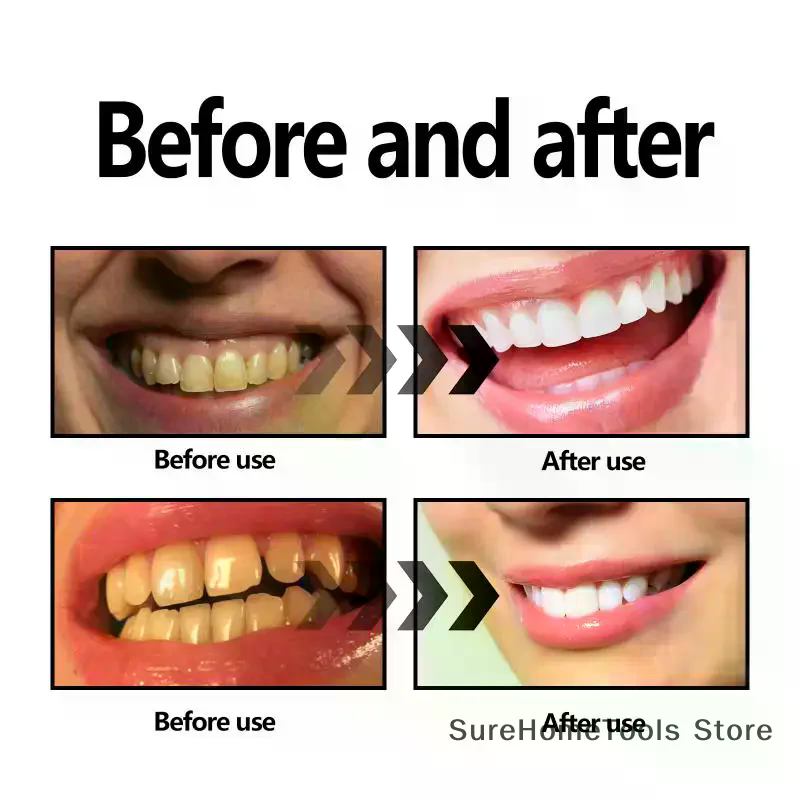 Порошок из бамбукового угля дл – обзор и цена Teeth Whitening Charcoal Powder