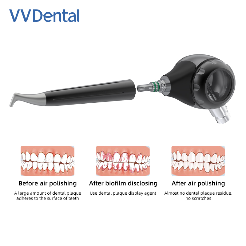 Воздушный полировщик VVDental, – обзор и цена Colgate Whitening Teeth