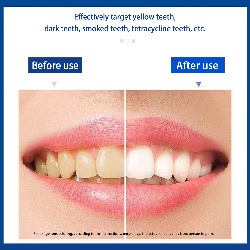 Полоски 5D для профессионально – обзор и цена Teeth Whitening Effects