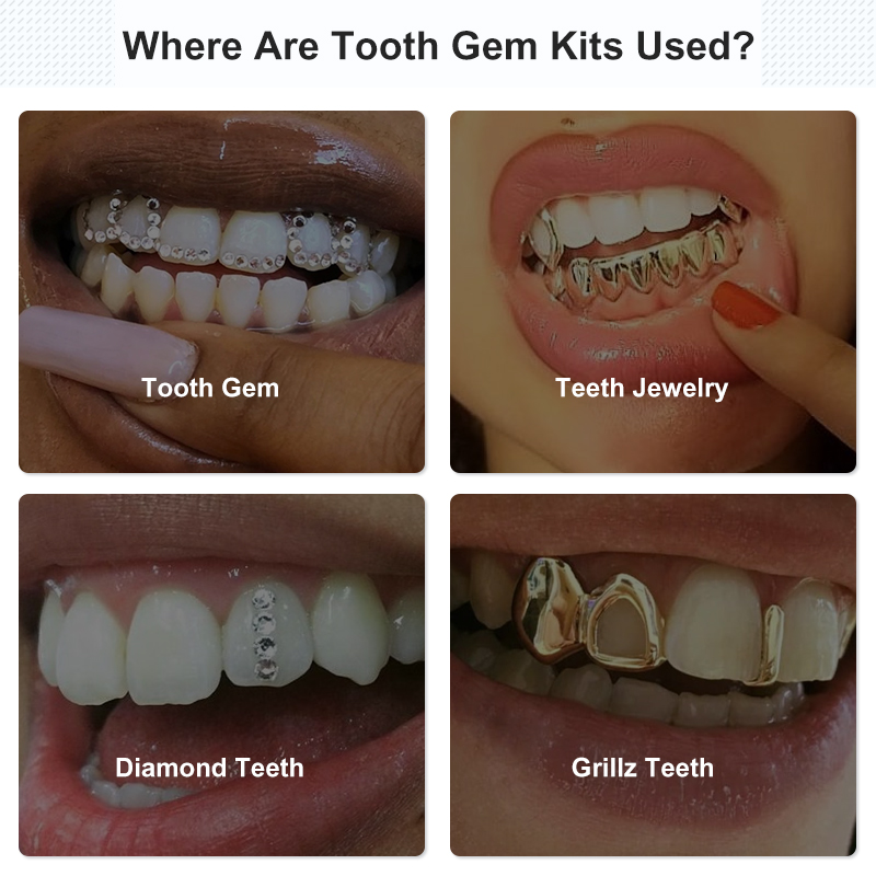 Набор клея для ювелирных издел – обзор и цена Tooth Gem Kit